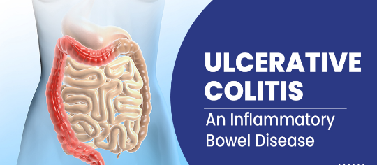 Homeopathy Treatment For Ulcerative Colitis